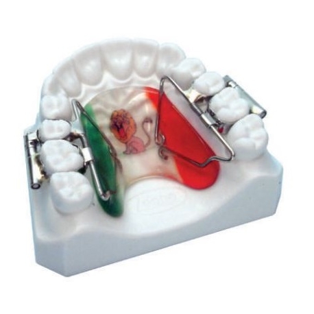Kit dispozitiv distalizare rapida molar First-Class