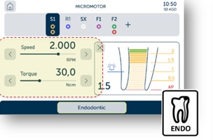 endo.jpg